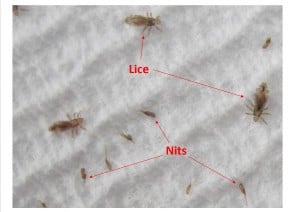 lice infestation